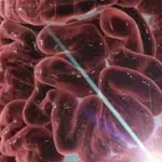 10 ερωτήσεις και απαντήσεις για τον καρκίνο του παχέος εντέρου και τον προσυμπτωματικό έλεγχο